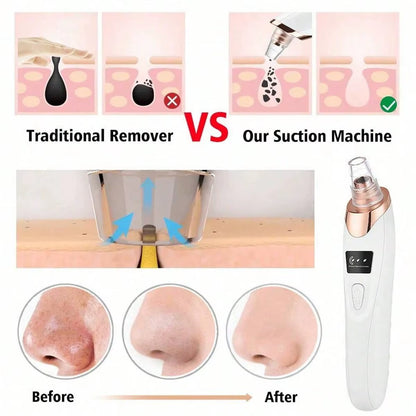 Electric Pore Cleaner & Blackhead Remover